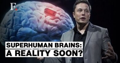"Neuralink's first human brain implant."